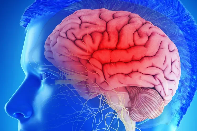 Understanding Dystonia: A Comprehensive Guide